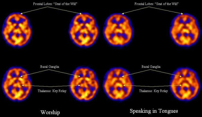 上图：2006年，宾夕法尼亚大学医学院的研究人员对在敬拜时（左）与说舌音（右）时的受试者进行了SPECT扫描。发现说舌音者的额叶（Frontal Lobes）活动减少，表示受到某种控制。与集中注意力和情绪反应有关的左基底神经节（left basal ganglia）的活动也减少。
